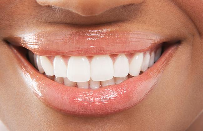 after-braces-are-removed-dental-braces-strathpoint-dental-family-general-dentist-strathmore-alberta