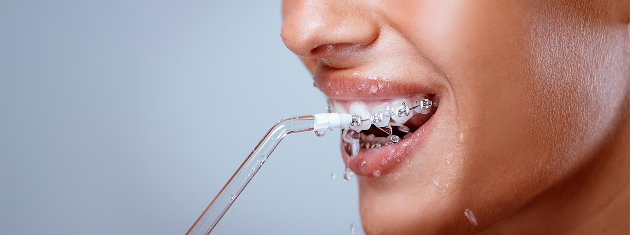 caring-for-your-smile-during-treatment-dental-braces-strathpoint-dental-family-general-dentist-strathmore-alberta